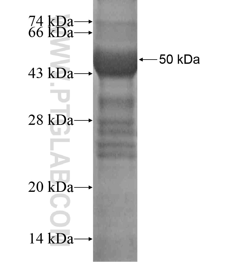 ZAP70 fusion protein Ag17527 SDS-PAGE