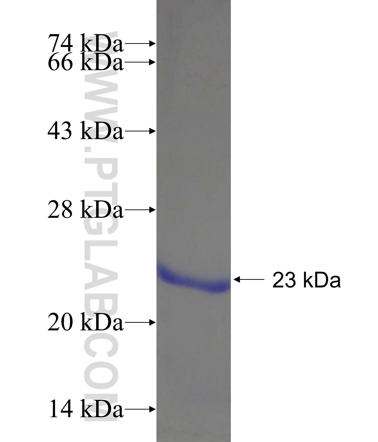 ZAP70 fusion protein Ag17655 SDS-PAGE