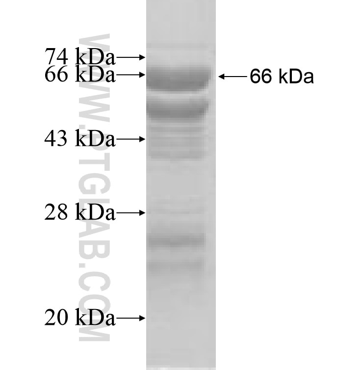 ZAP70 fusion protein Ag7943 SDS-PAGE