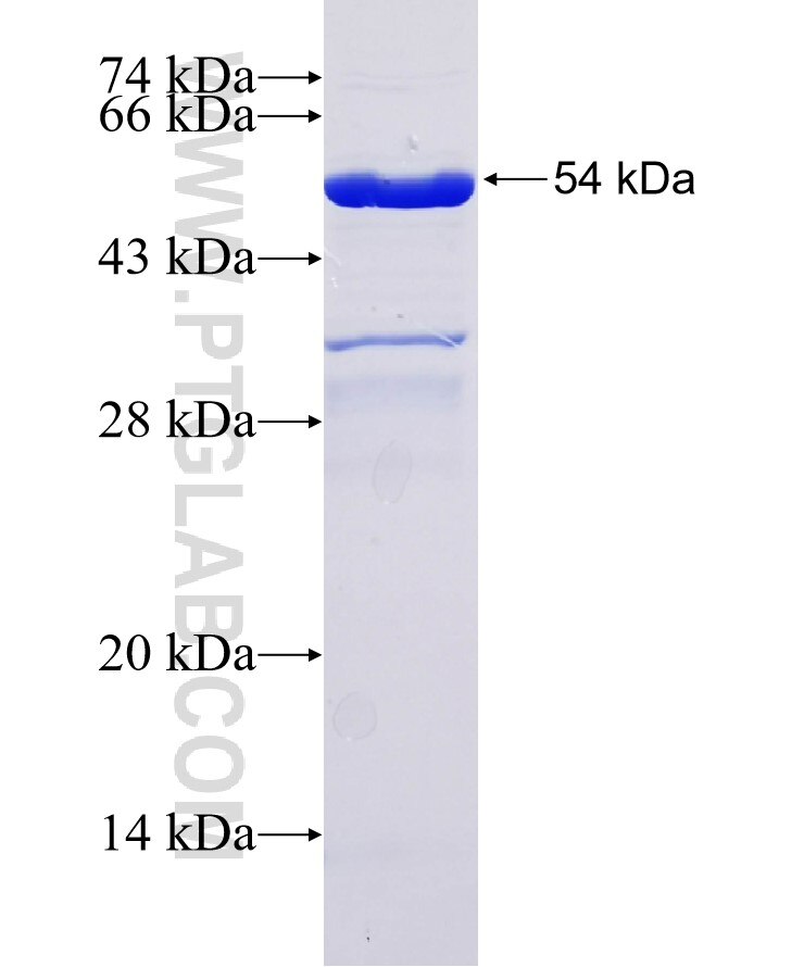 ZAR1 fusion protein Ag34679 SDS-PAGE
