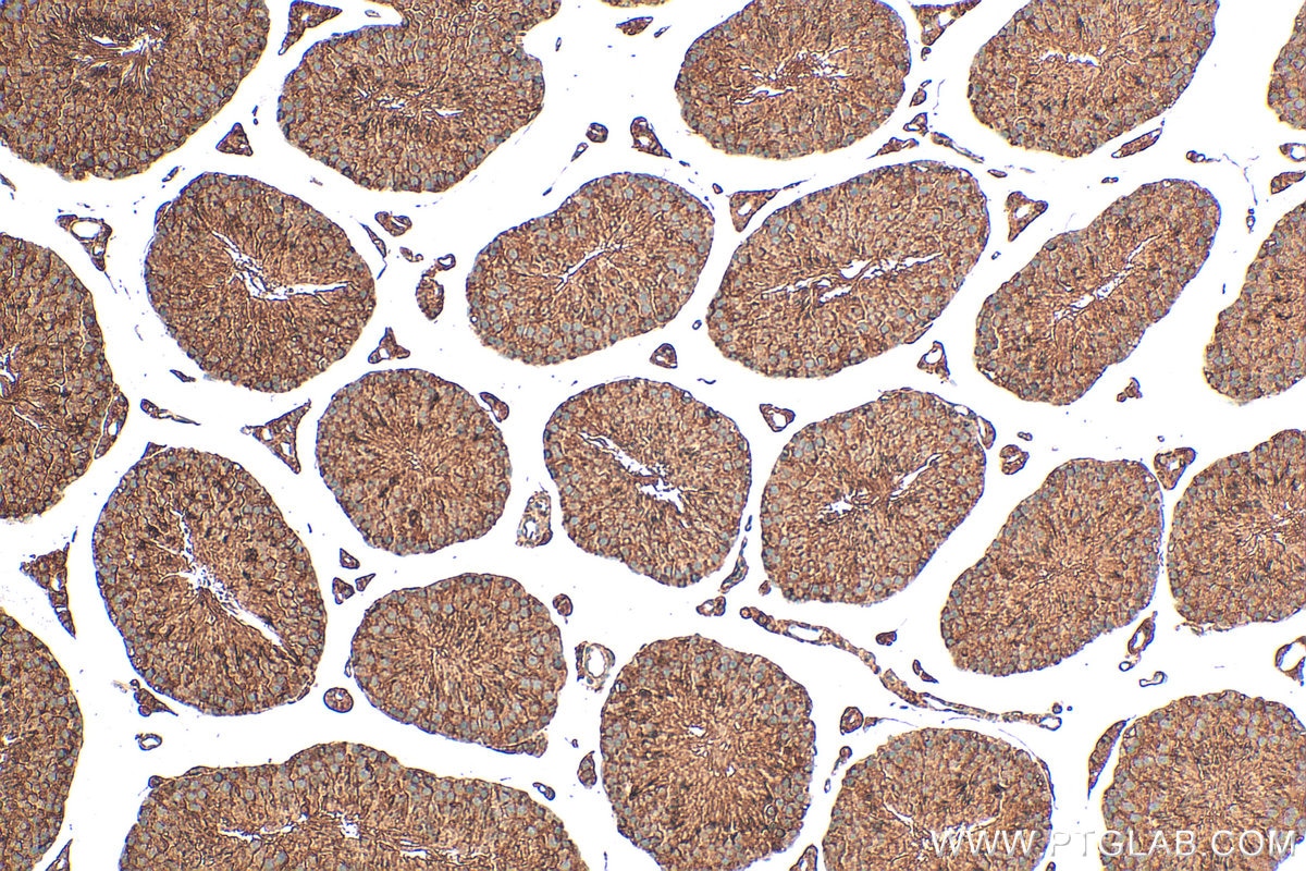 IHC staining of mouse testis using 23958-1-AP Immunohistochemistry (IHC) staining of mouse testis tissue using ZBBX Polyclonal antibody (23958-1-AP)
