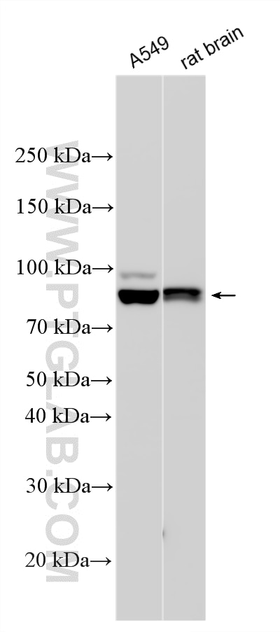 WB analysis using 23958-1-AP Western Blot (WB) analysis of various lysates using ZBBX Polyclonal antibody (23958-1-AP)