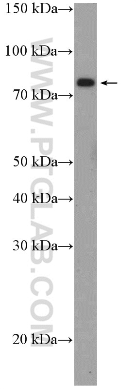 Western Blot (WB) analysis of mouse heart tissue using ZBED1 Polyclonal antibody (26140-1-AP)