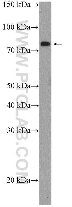 WB analysis of mouse heart using 26140-1-AP