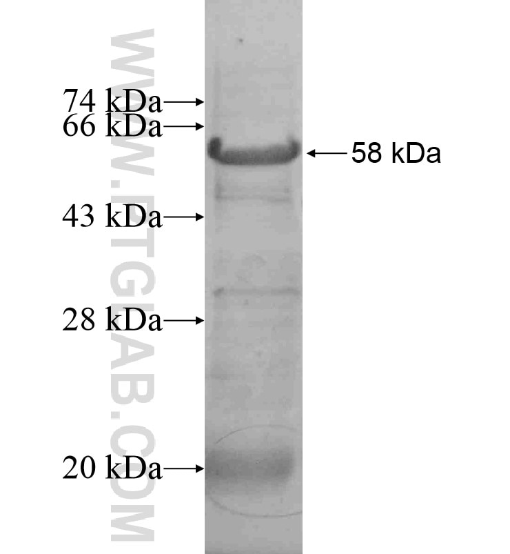ZBED4 fusion protein Ag16518 SDS-PAGE
