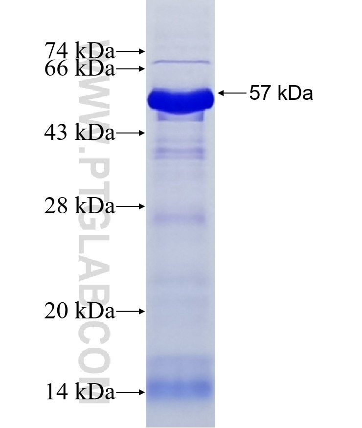 ZBED4 fusion protein Ag16518 SDS-PAGE