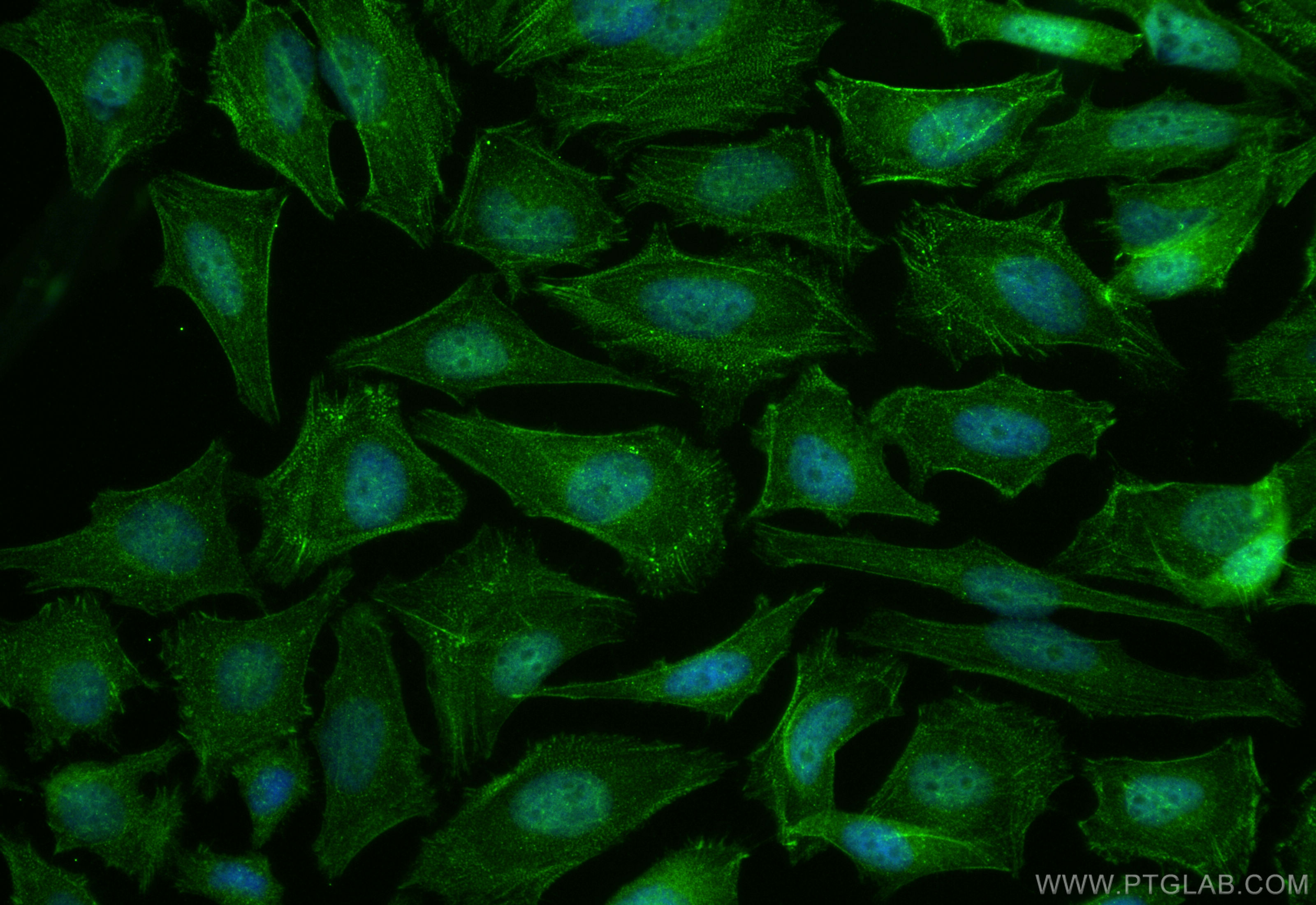 Immunofluorescence (IF) / fluorescent staining of HeLa cells using ZBP1 Polyclonal antibody (13285-1-AP)