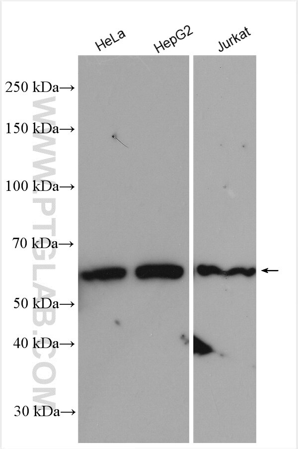 Western Blot (WB) analysis of various lysates using ZBP1 Polyclonal antibody (13285-1-AP)