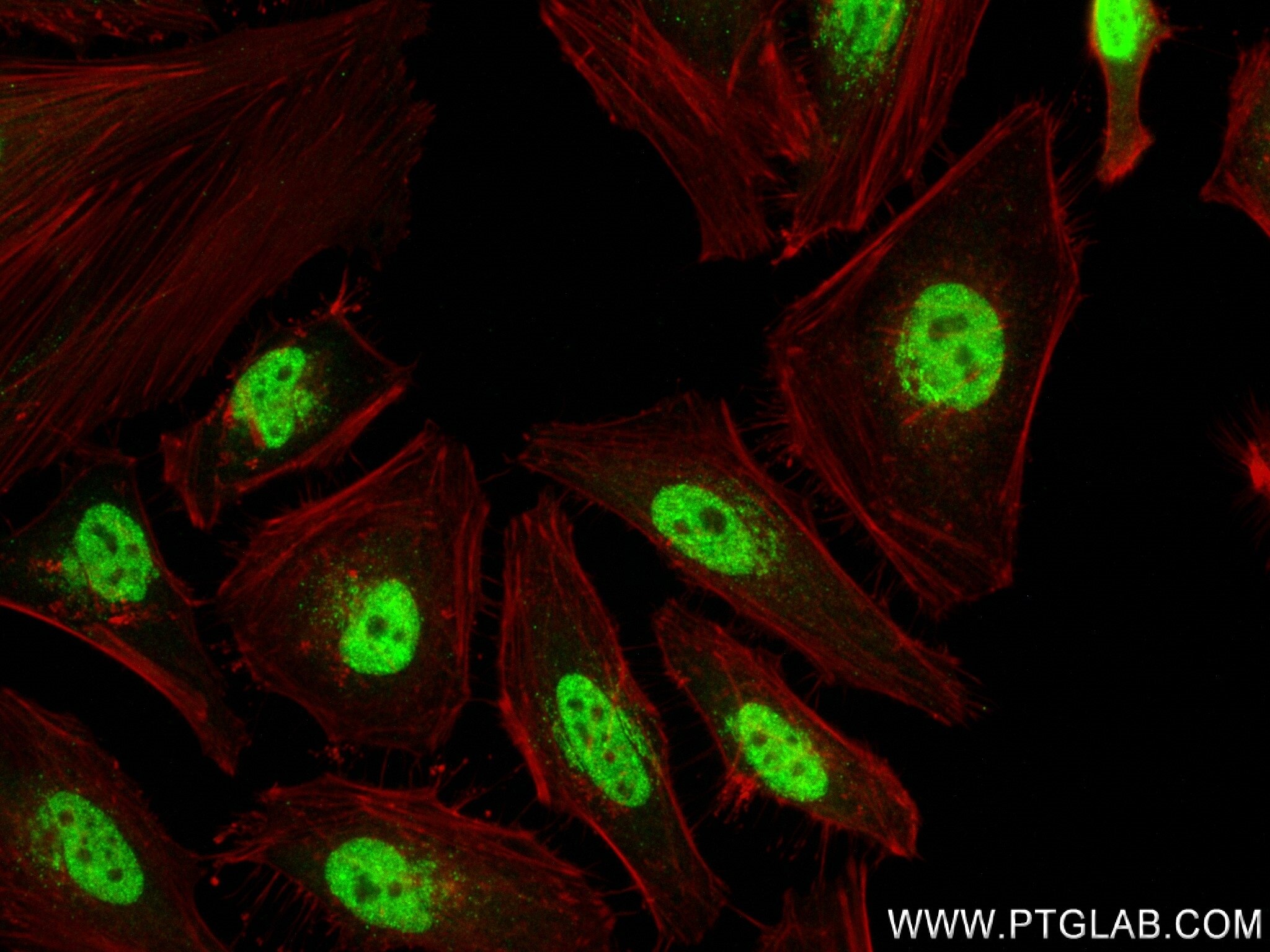 Immunofluorescence (IF) / fluorescent staining of HeLa cells using ZBP1 Recombinant antibody (84396-2-RR)