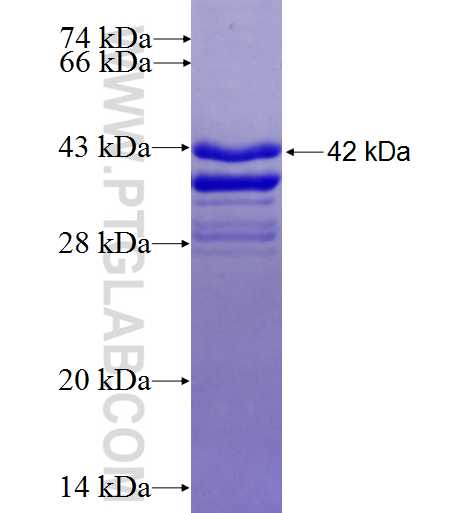 ZBP1 fusion protein Ag4119 SDS-PAGE