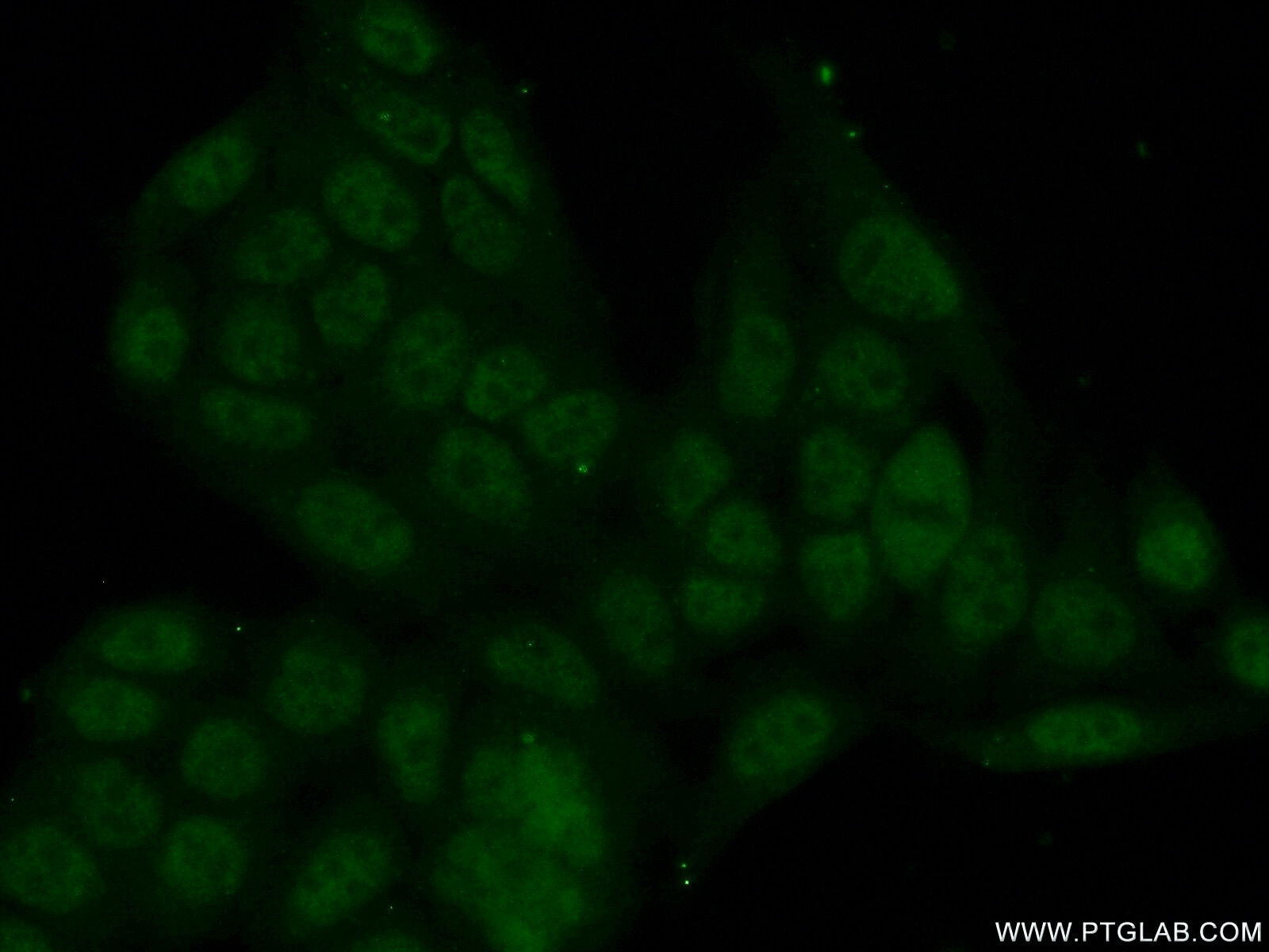 Immunofluorescence (IF) / fluorescent staining of HeLa cells using ZBTB1 Polyclonal antibody (26287-1-AP)