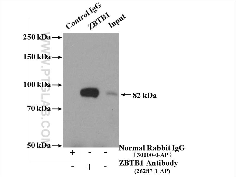 Immunoprecipitation (IP) experiment of HeLa cells using ZBTB1 Polyclonal antibody (26287-1-AP)