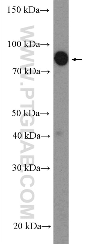 Western Blot (WB) analysis of HeLa cells using ZBTB1 Polyclonal antibody (26287-1-AP)