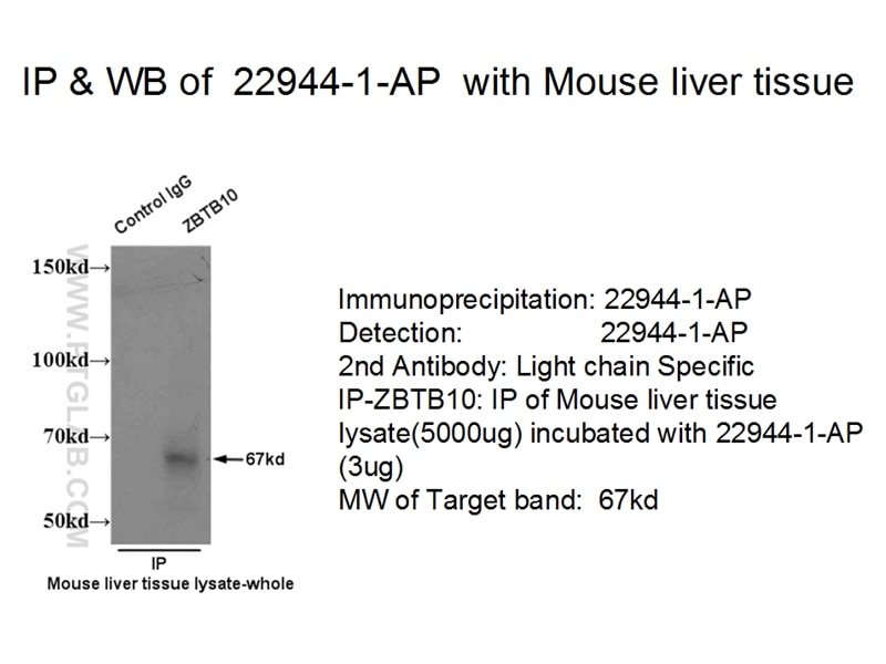 Immunoprecipitation (IP) experiment using ZBTB10 Polyclonal antibody (22944-1-AP)