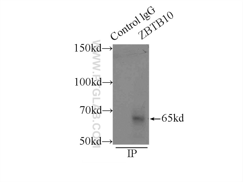 Immunoprecipitation (IP) experiment of mouse liver tissue using ZBTB10 Polyclonal antibody (22944-1-AP)