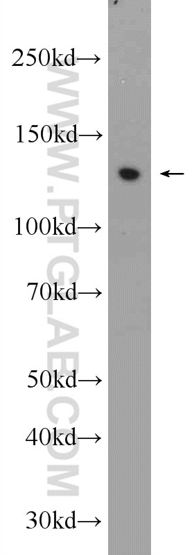 Western Blot (WB) analysis of A375 cells using ZBTB10 Polyclonal antibody (22944-1-AP)