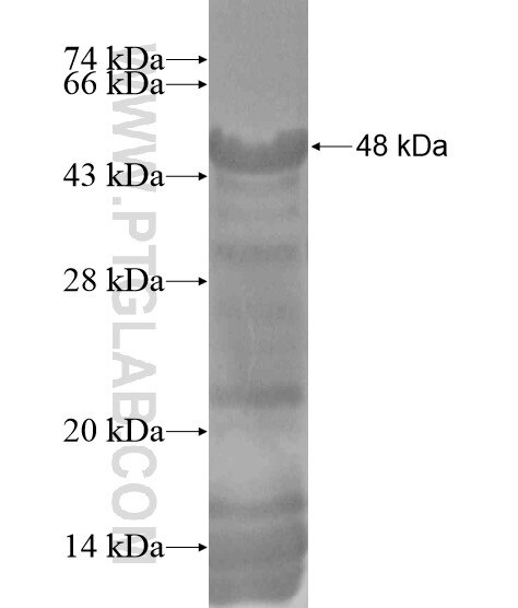 ZBTB10 fusion protein Ag19094 SDS-PAGE