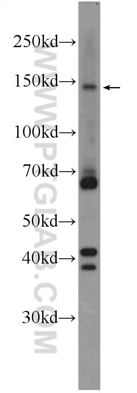 Western Blot (WB) analysis of PC-3 cells using ZBTB11 Polyclonal antibody (25215-1-AP)