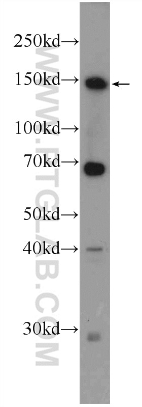 Western Blot (WB) analysis of mouse liver tissue using ZBTB11 Polyclonal antibody (25215-1-AP)