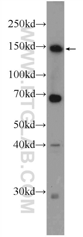 WB analysis of mouse liver using 25215-1-AP