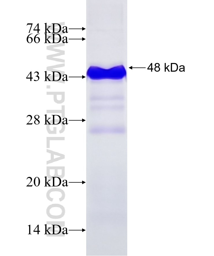 ZBTB17 fusion protein Ag18255 SDS-PAGE