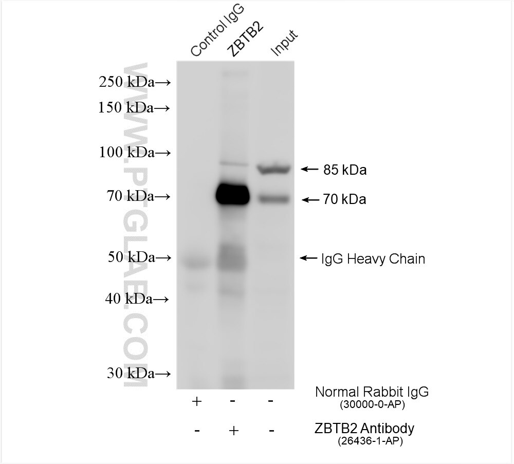 Immunoprecipitation (IP) experiment of HEK-293T cells using ZBTB2 Polyclonal antibody (26436-1-AP)