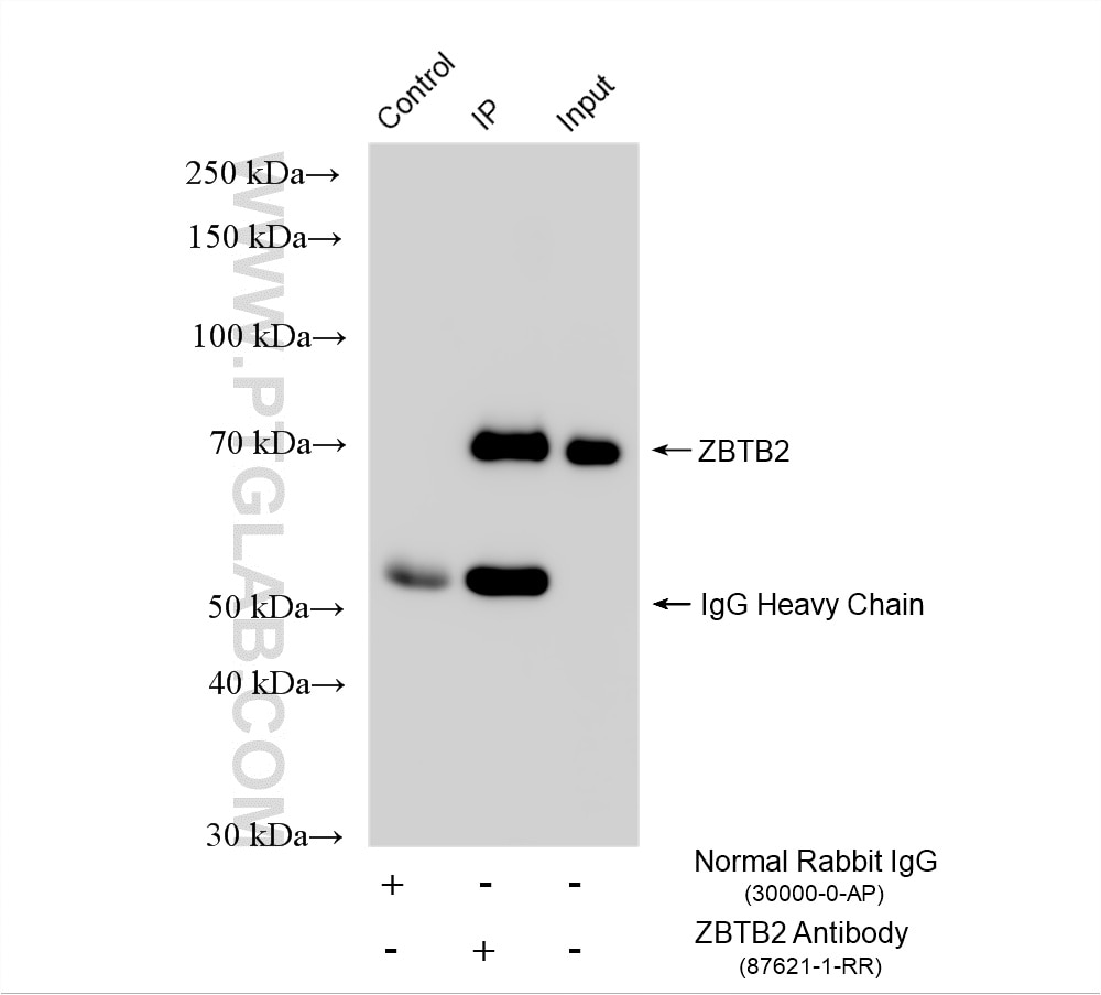 IP experiment of HEK-293T using 87621-1-RR Immunoprecipitation (IP) experiment of HEK-293T cells using ZBTB2 Recombinant monoclonal antibody (87621-1-RR)