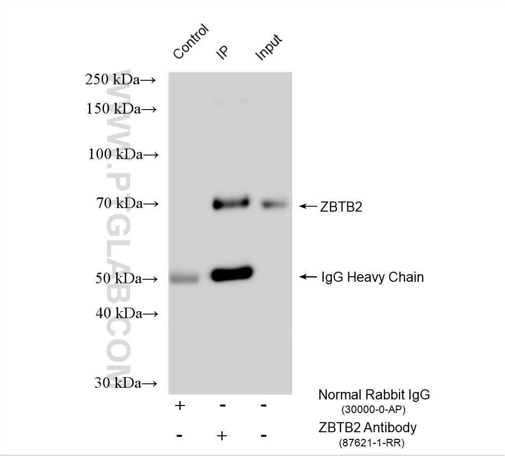 IP experiment of K-562 using 87621-1-RR Immunoprecipitation (IP) experiment of K-562 cells using ZBTB2 Recombinant monoclonal antibody (87621-1-RR)