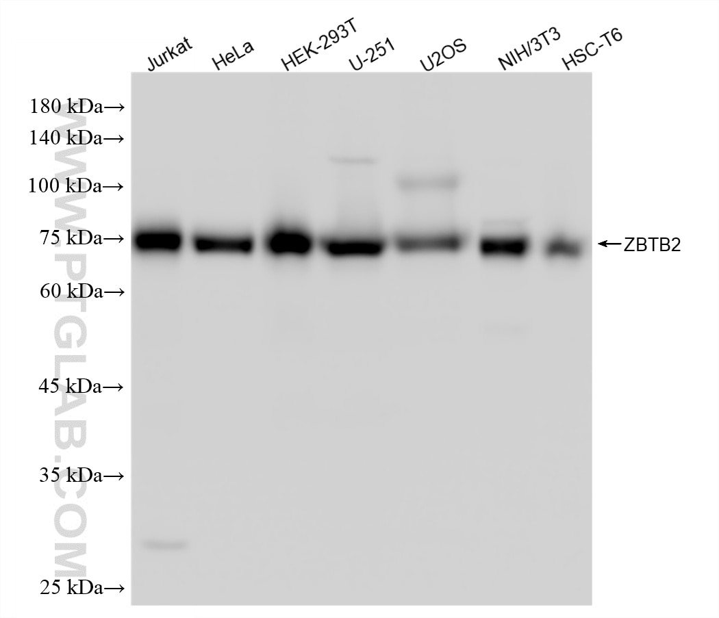 Western Blot (WB) analysis of various lysates using ZBTB2 Recombinant monoclonal antibody (87621-1-RR)