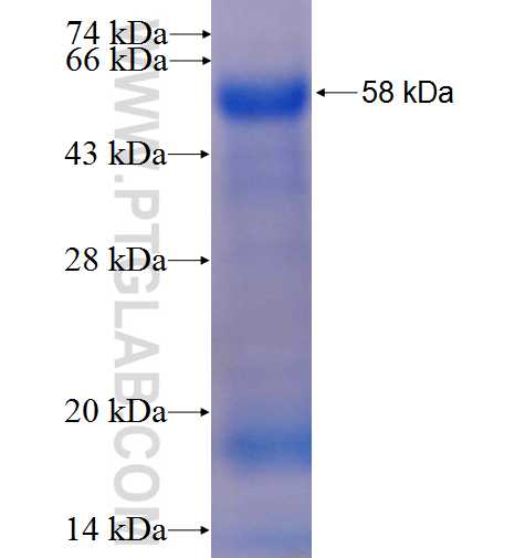 ZBTB2 fusion protein Ag23897 SDS-PAGE