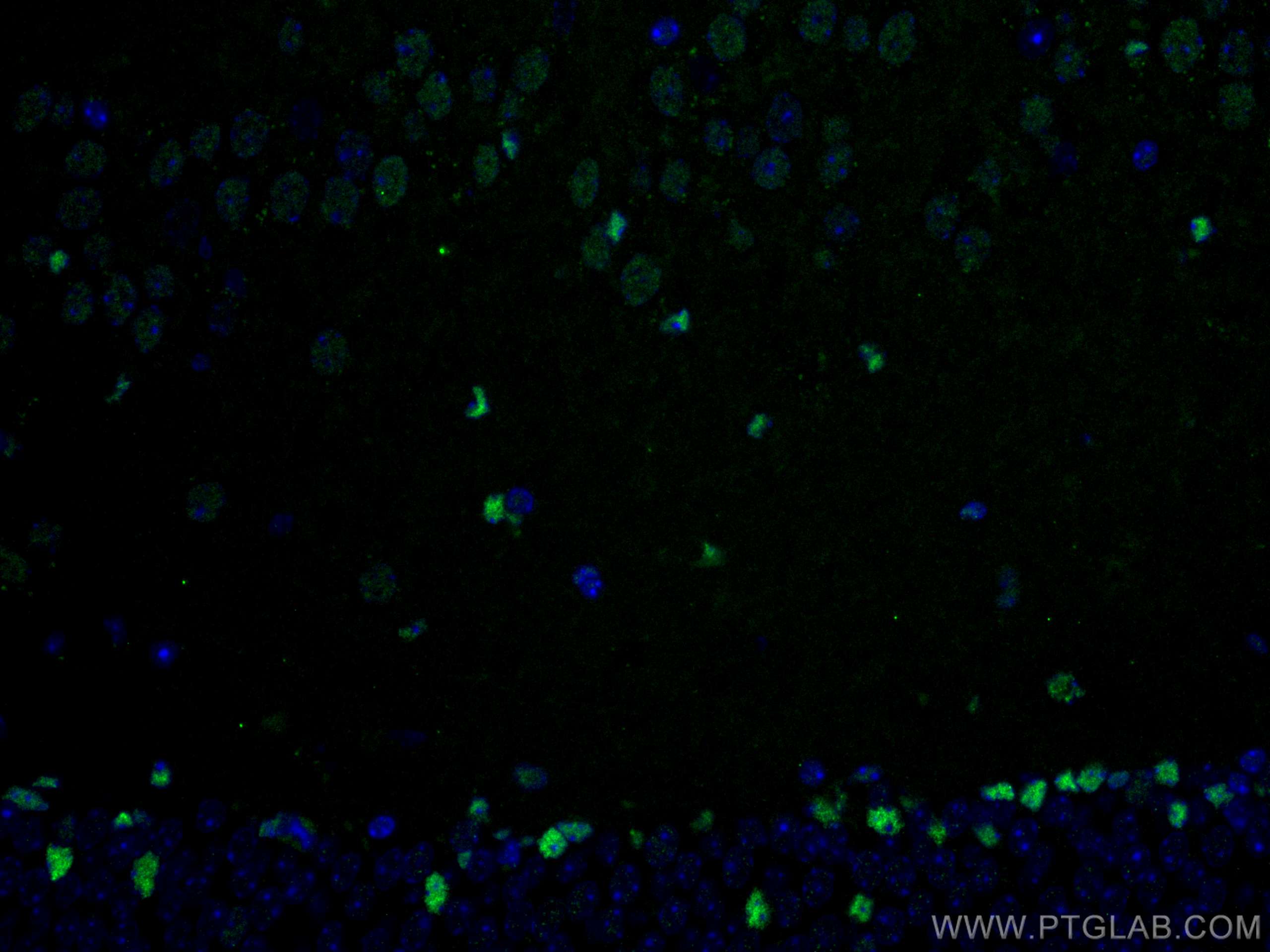 Immunofluorescence (IF) / fluorescent staining of mouse brain tissue using ZBTB20 Polyclonal antibody (23987-1-AP)
