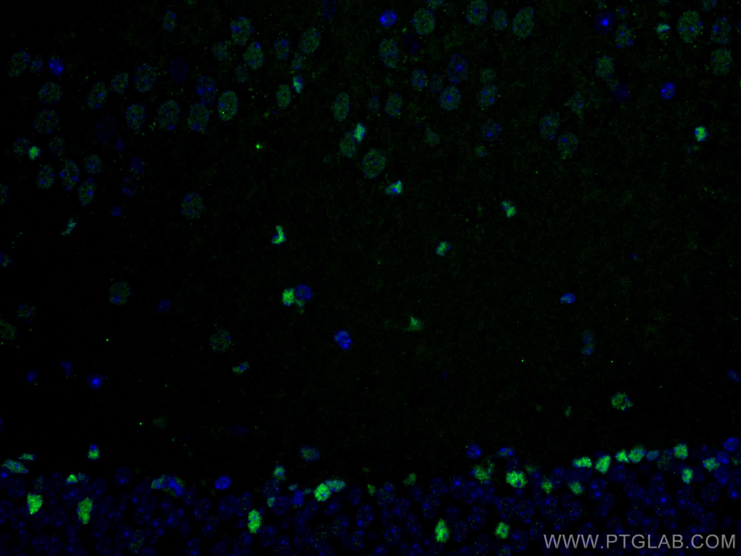 Immunofluorescence (IF) / fluorescent staining of mouse brain tissue using ZBTB20 Polyclonal antibody (23987-1-AP)