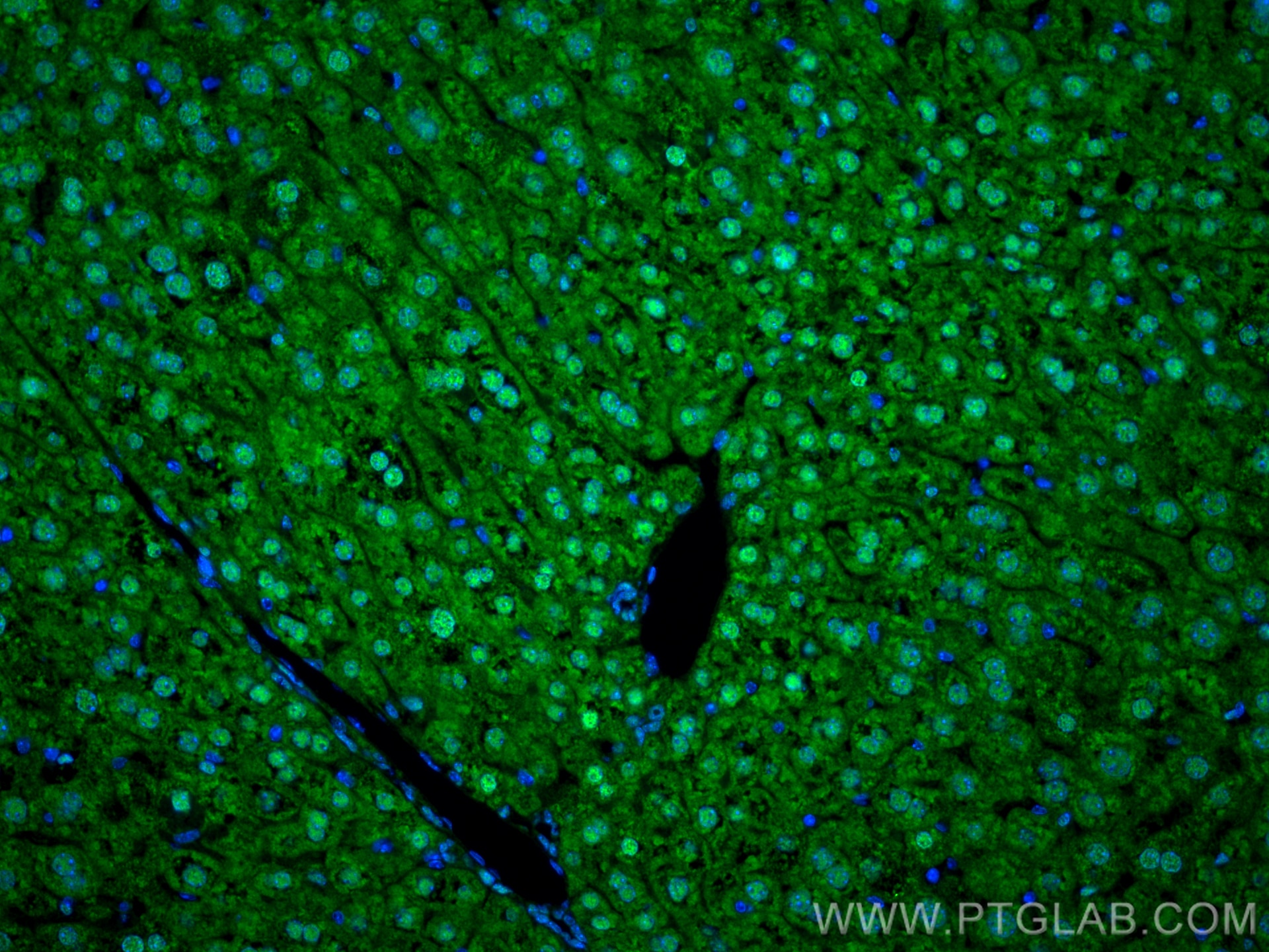 Immunofluorescence (IF) / fluorescent staining of mouse liver tissue using ZBTB20 Polyclonal antibody (23987-1-AP)