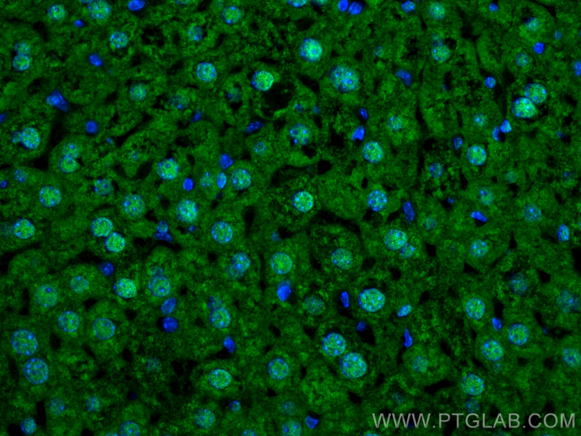 Immunofluorescence (IF) / fluorescent staining of mouse liver tissue using ZBTB20 Polyclonal antibody (23987-1-AP)