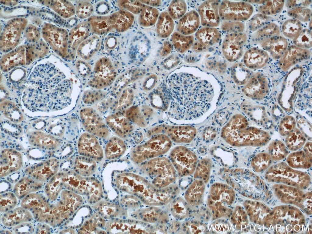 Immunohistochemistry (IHC) staining of human kidney tissue using ZBTB20 Polyclonal antibody (23987-1-AP)