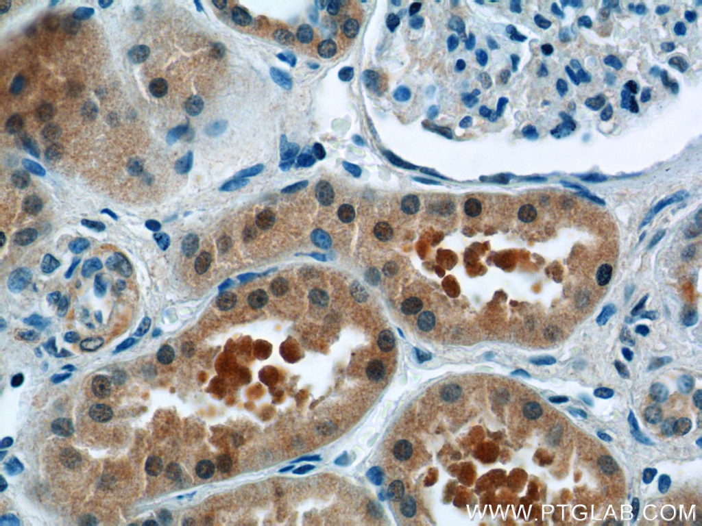 Immunohistochemistry (IHC) staining of human kidney tissue using ZBTB20 Polyclonal antibody (23987-1-AP)