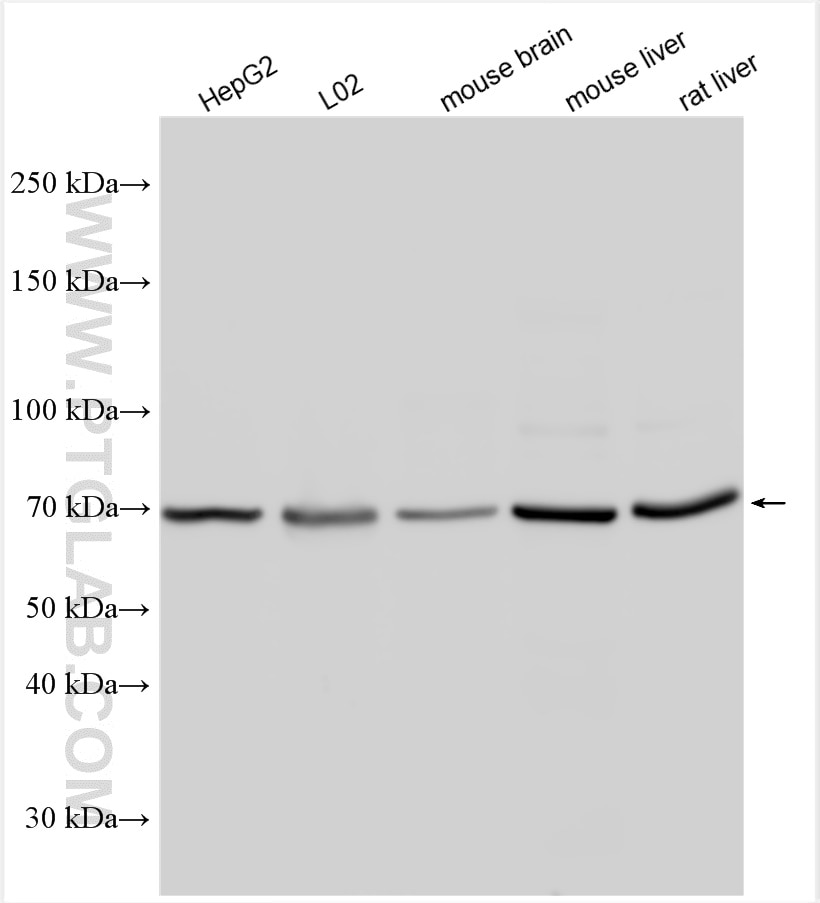 Western Blot (WB) analysis of various lysates using ZBTB20 Polyclonal antibody (23987-1-AP)