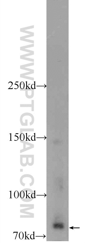 Western Blot (WB) analysis of mouse brain tissue using ZBTB20 Polyclonal antibody (23987-1-AP)