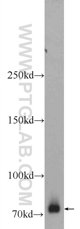 Western Blot (WB) analysis of HEK-293 cells using ZBTB20 Polyclonal antibody (23987-1-AP)