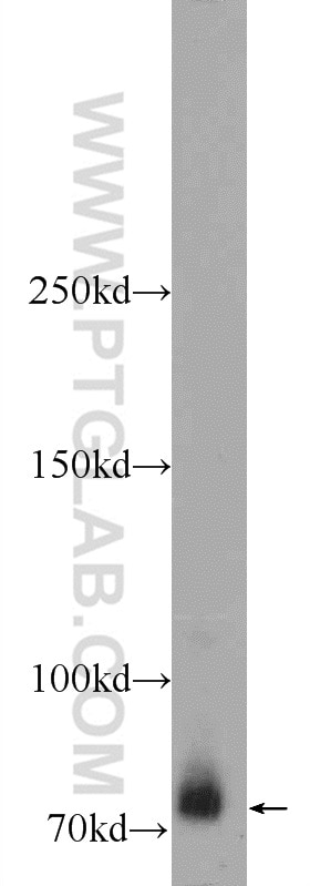 Western Blot (WB) analysis of HepG2 cells using ZBTB20 Polyclonal antibody (23987-1-AP)