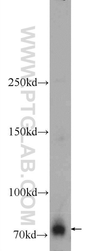 Western Blot (WB) analysis of mouse liver tissue using ZBTB20 Polyclonal antibody (23987-1-AP)