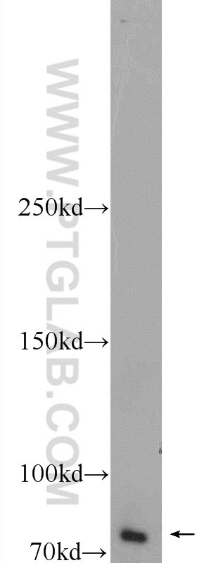 Western Blot (WB) analysis of Jurkat cells using ZBTB20 Polyclonal antibody (23987-1-AP)