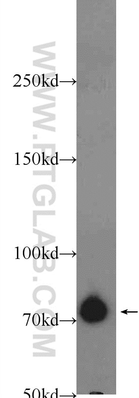 Western Blot (WB) analysis of RAW 264.7 cells using ZBTB20 Polyclonal antibody (23987-1-AP)