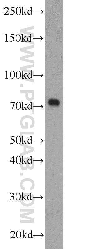 Western Blot (WB) analysis of L02 cells using ZBTB20 Polyclonal antibody (23987-1-AP)