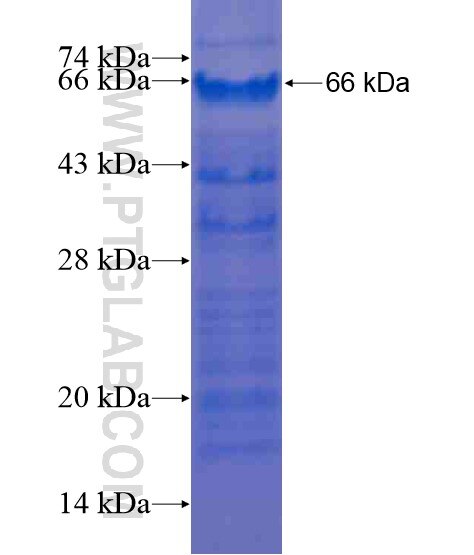 ZBTB20 fusion protein Ag21140 SDS-PAGE