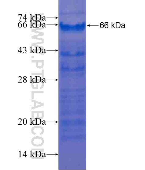 ZBTB20 fusion protein Ag21140 SDS-PAGE