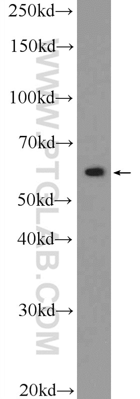 Western Blot (WB) analysis of mouse brain tissue using ZBTB22 Polyclonal antibody (25633-1-AP)