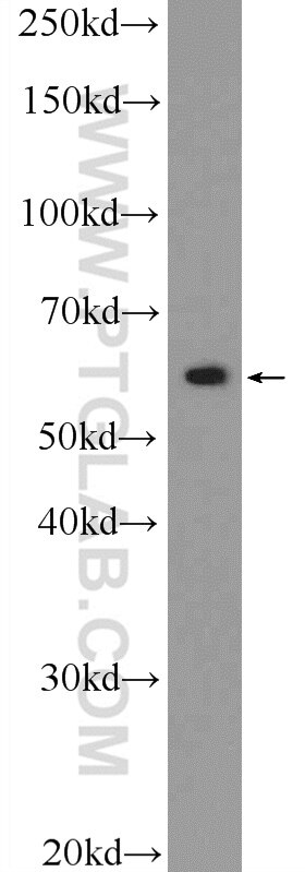 WB analysis of mouse brain using 25633-1-AP