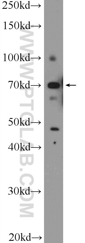 Western Blot (WB) analysis of A549 cells using ZBTB22 Polyclonal antibody (25633-1-AP)