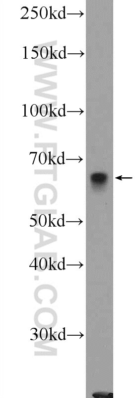 Western Blot (WB) analysis of mouse brain tissue using ZBTB22 Polyclonal antibody (25633-1-AP)